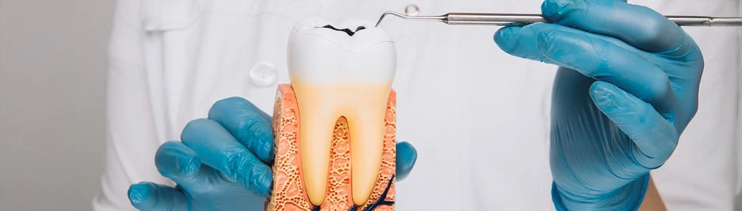 20'lik Diş Çekimi (Gömülü Diş Çekimi) - Sonrası- Ağrısı- Fiyatları İzmir