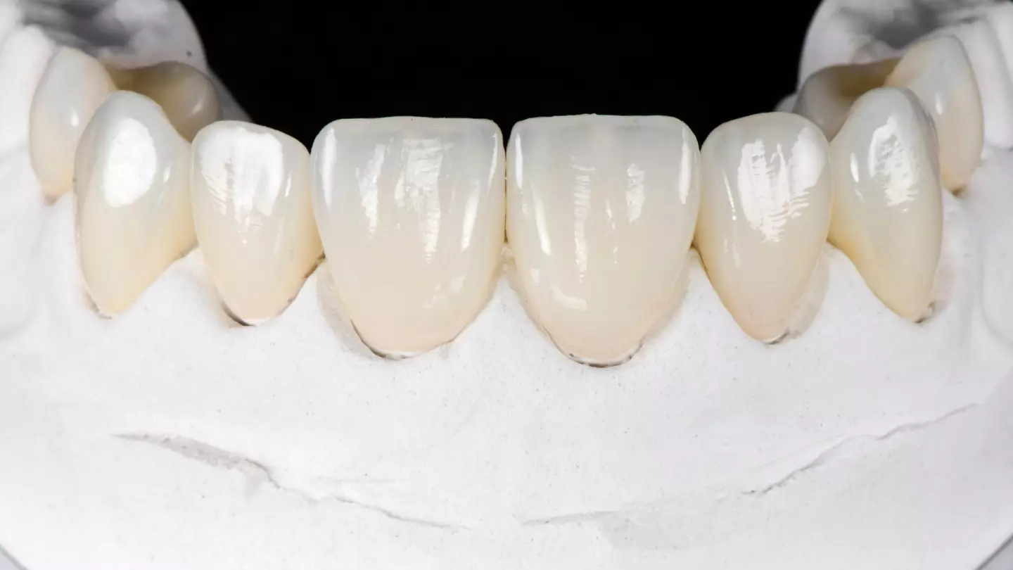 Zirkonyum Diş Kaplama Tedavisi