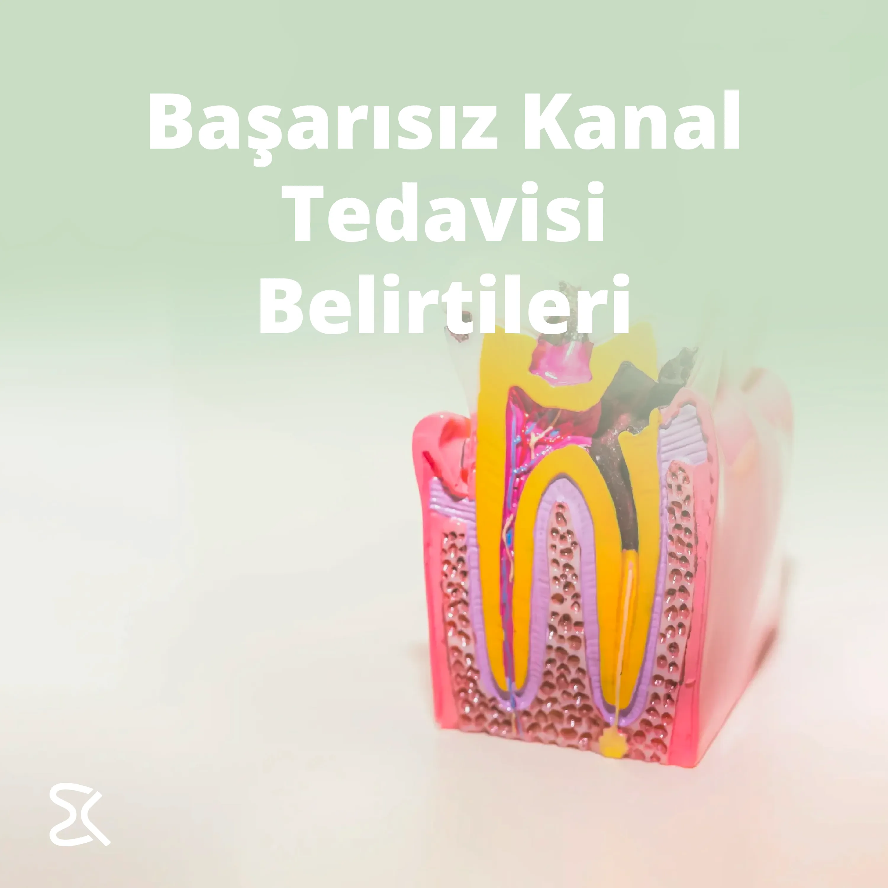Başarısız Kanal Tedavisi Belirtileri