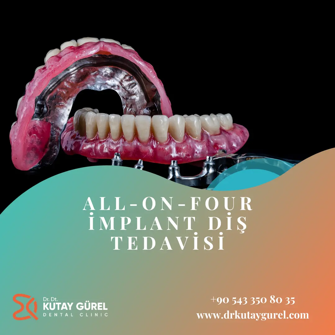 İzmir Çiğli - All-on-Four İmplant Diş Tedavisi