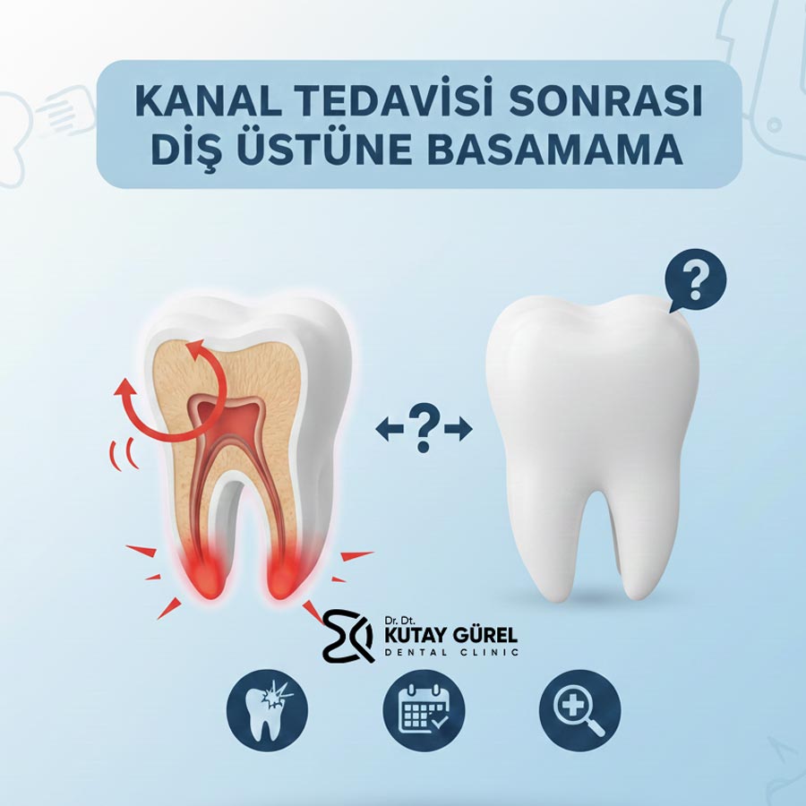 Kanal Tedavisi Sonrası Diş Üstüne Basamama: Ağrı Normal mi, Ne Zaman Doktora Gidilmeli?