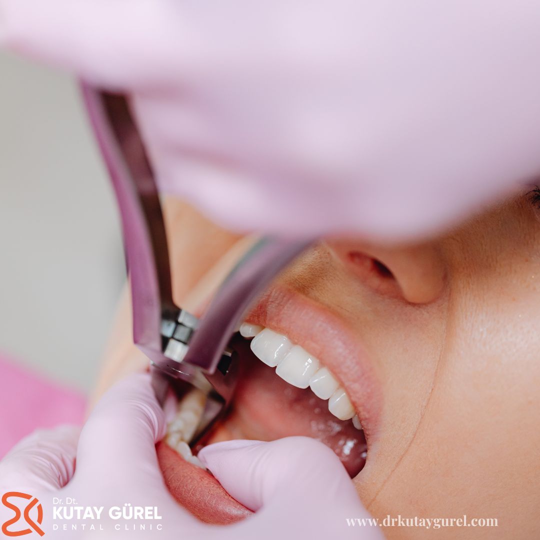 Sadece Kökü Kalan Diş Tedavisi