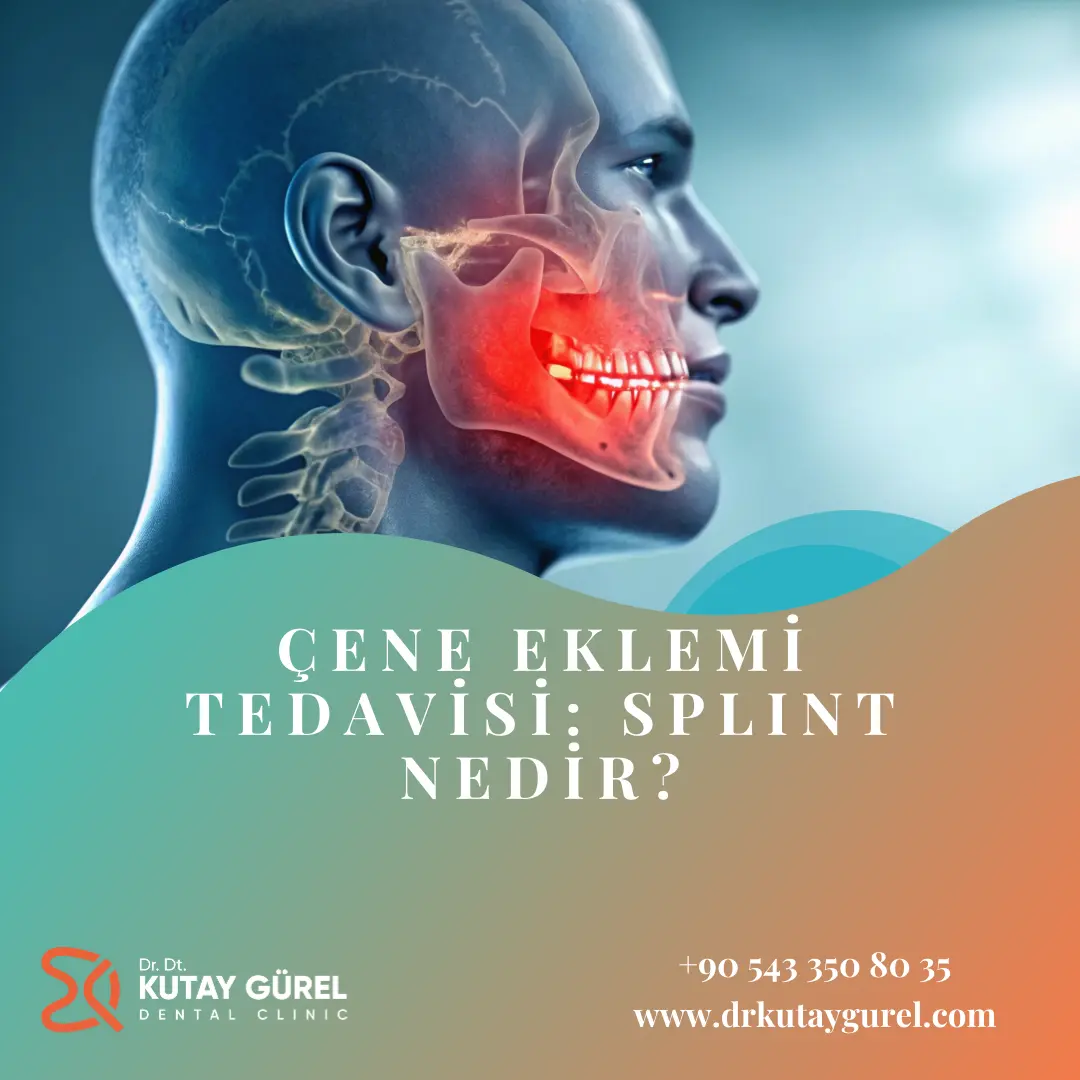 Çene Eklemi Tedavisi: Splint Nedir?