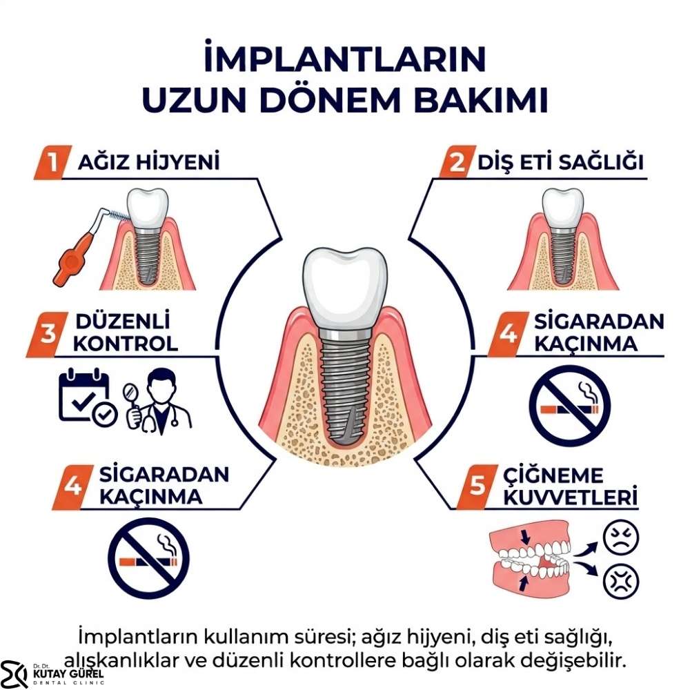 İmplant diş tedavisi Nasıl Yapılır İzmir