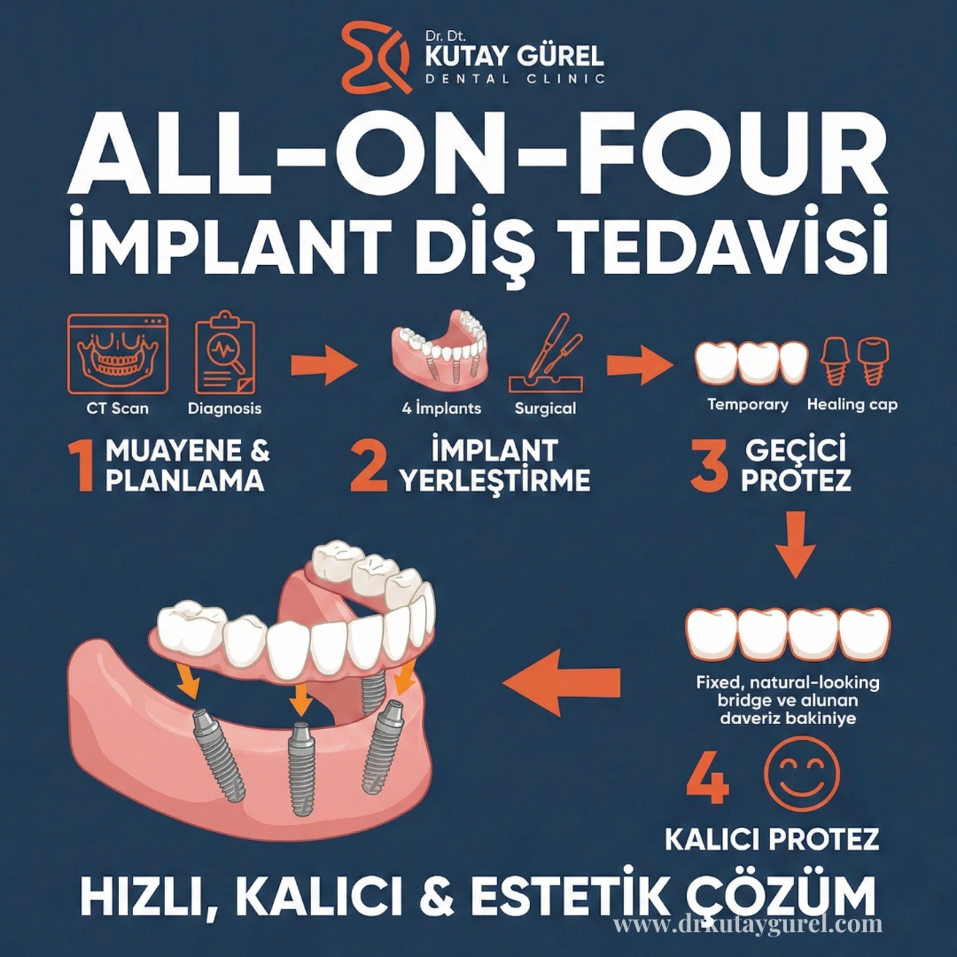 İzmir Çiğli All-on-Four İmplant Diş Tedavisi