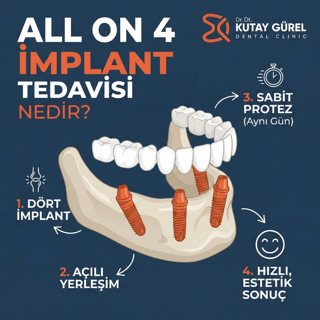 izmir'de implant yapan en iyi diş hekimleri