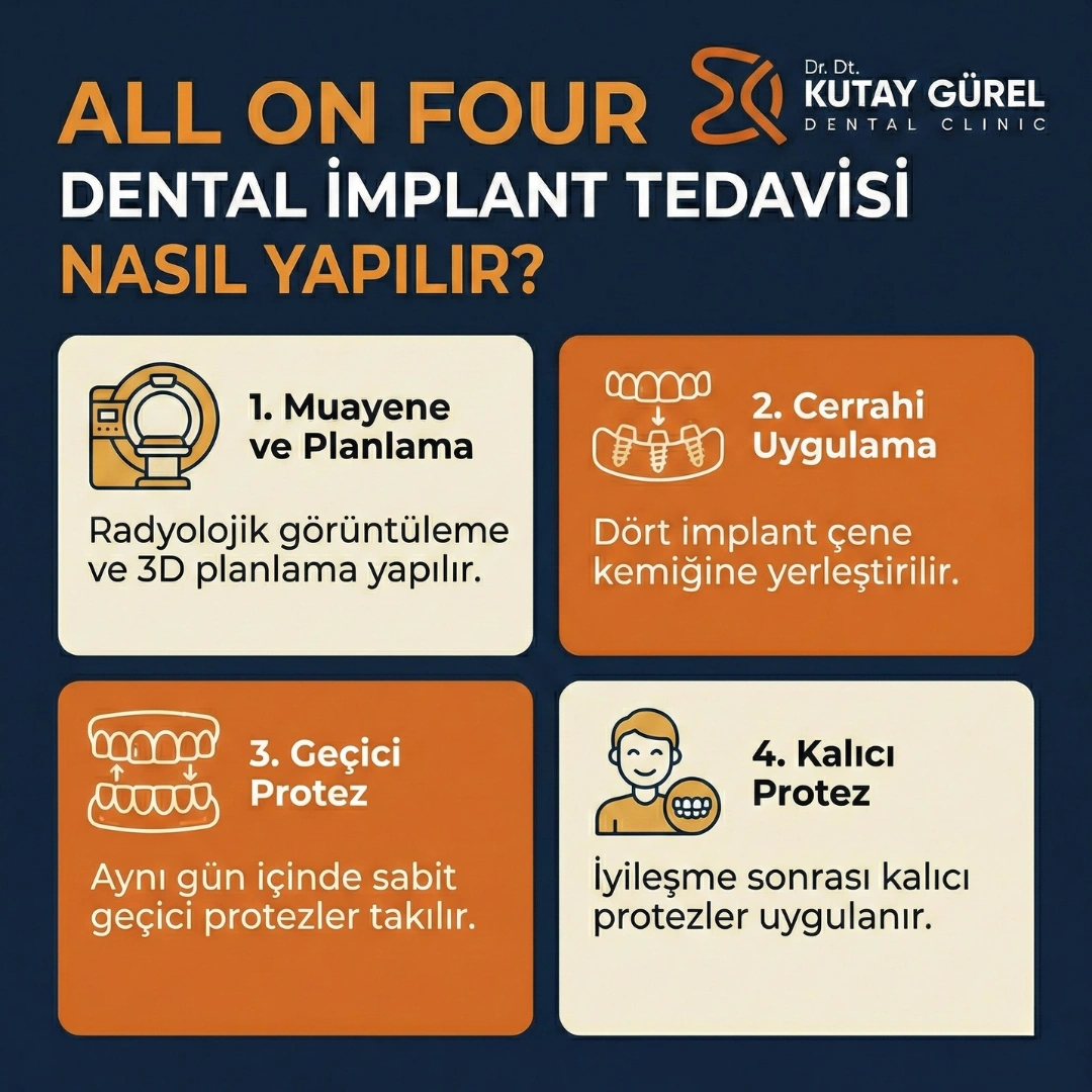 All-on-Four Dental İzmir İmplant Tedavisi 