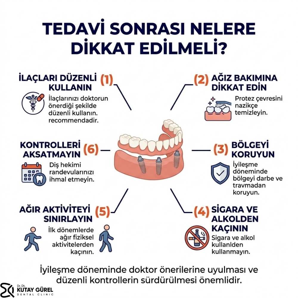 All-on-Four-All-on-Six-İmplant