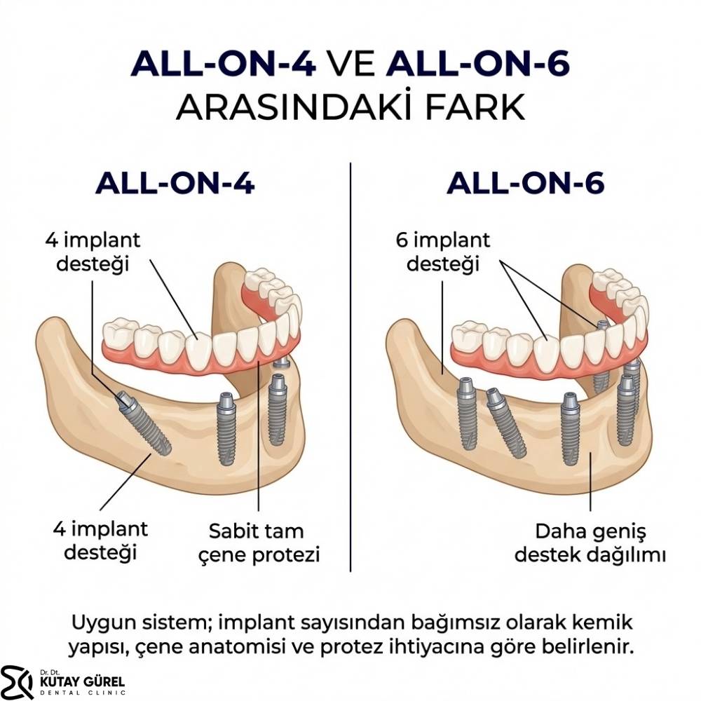 acısız implant İzmir