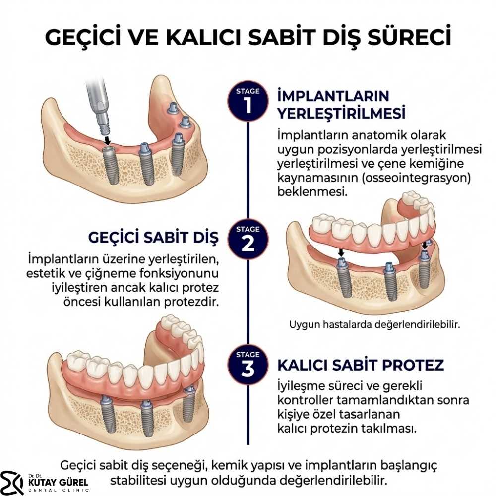 Çiğli all on six diş i̇mplant izmir