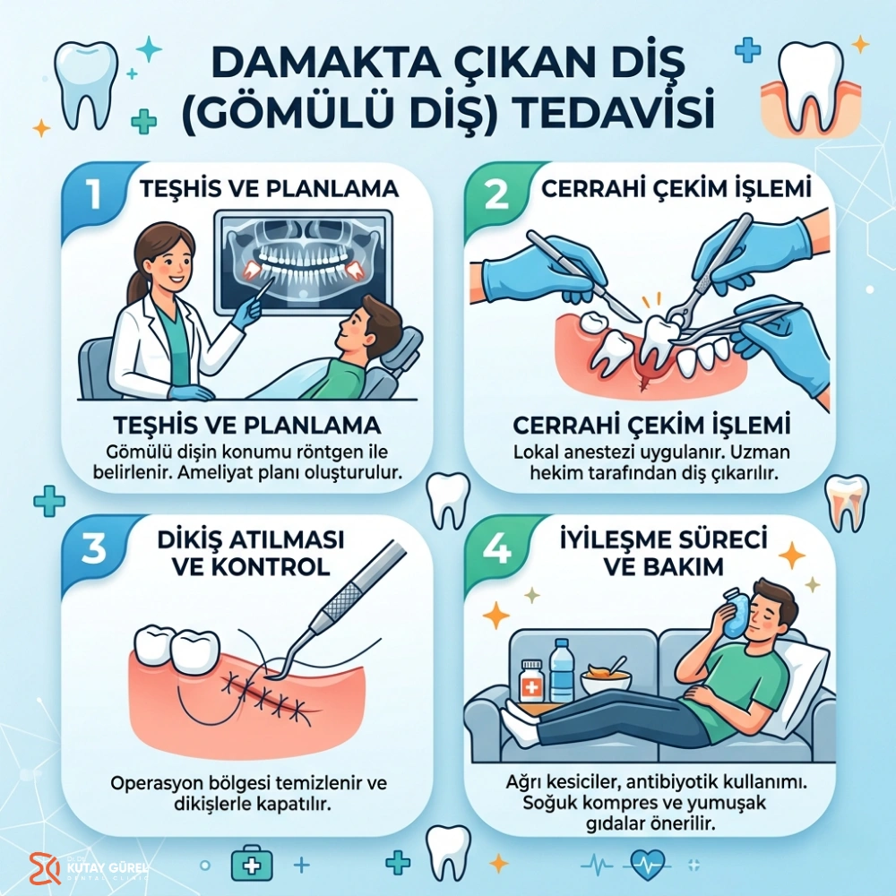 çocuklarda damakta diş çıkması