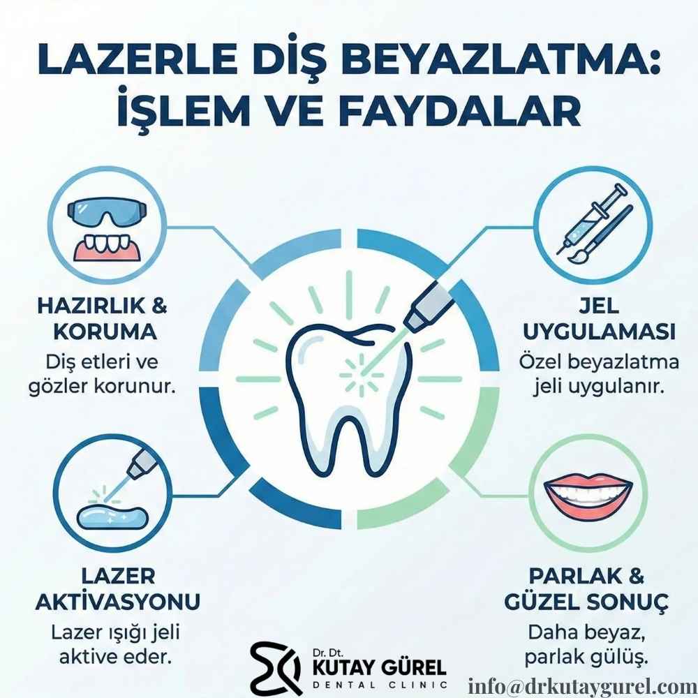Lazer diş beyazlatma kalıcı mıdır