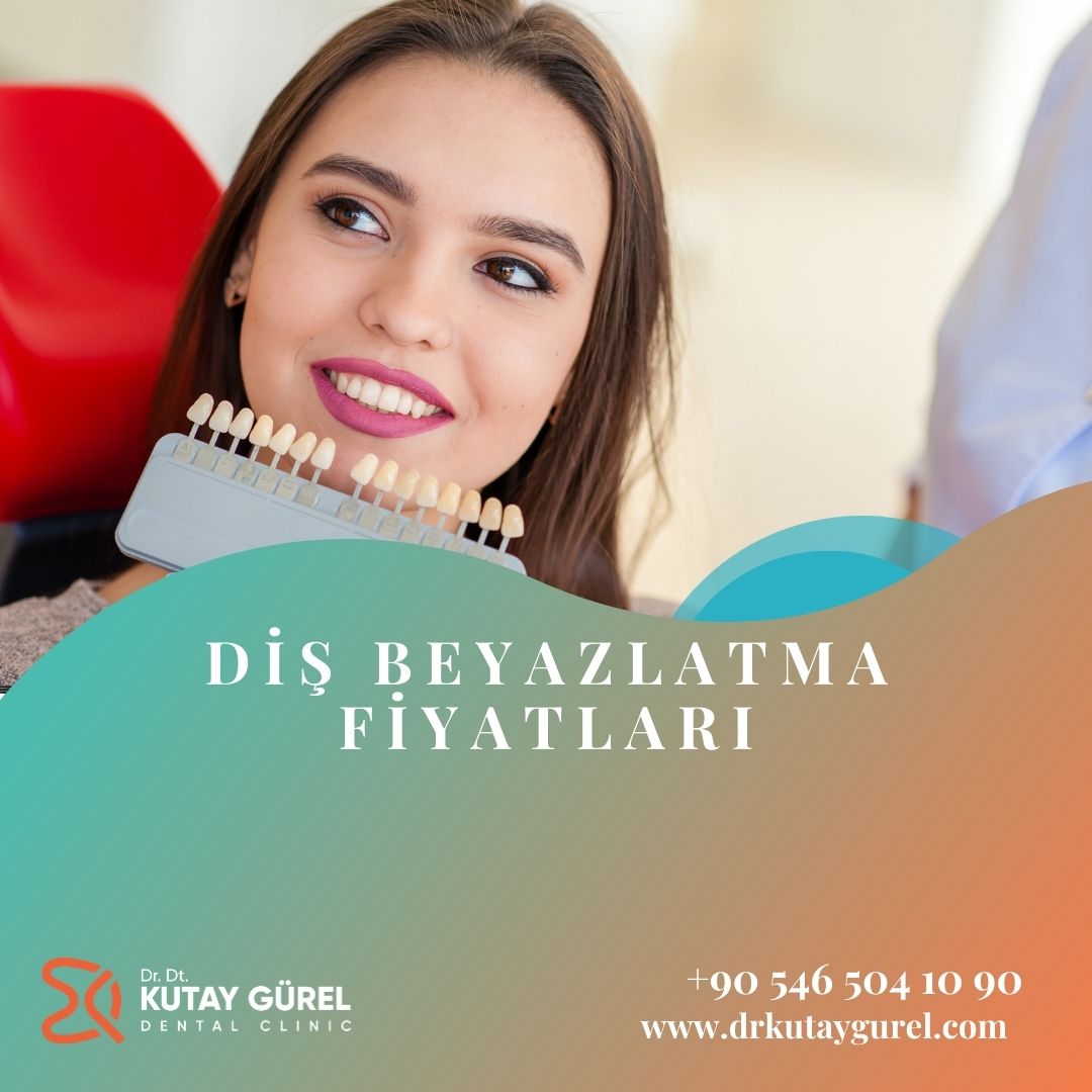 Diş Beyazlatma Fiyatlari