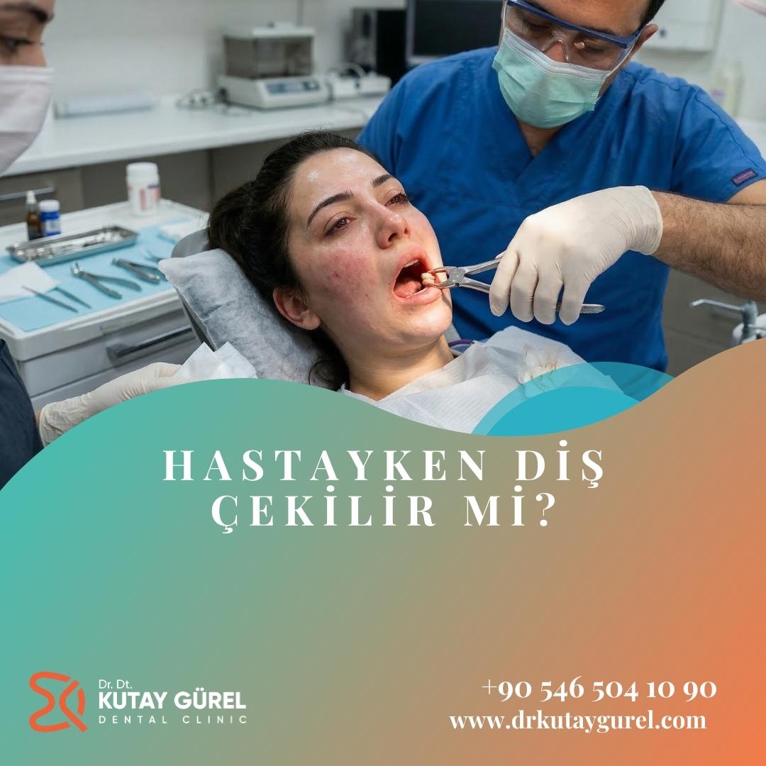 gripken diş çekilir mi