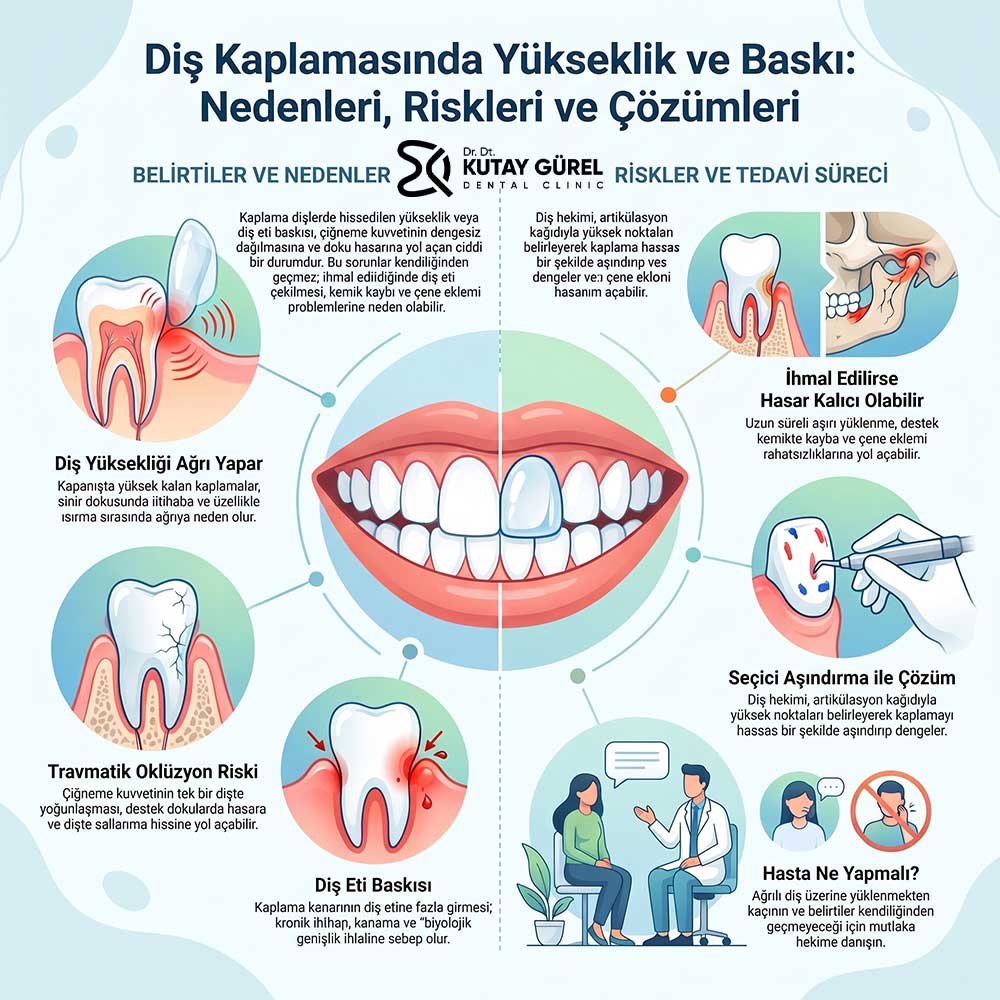 Kaplama diş etine baskı yaparsa Ne  Olur
