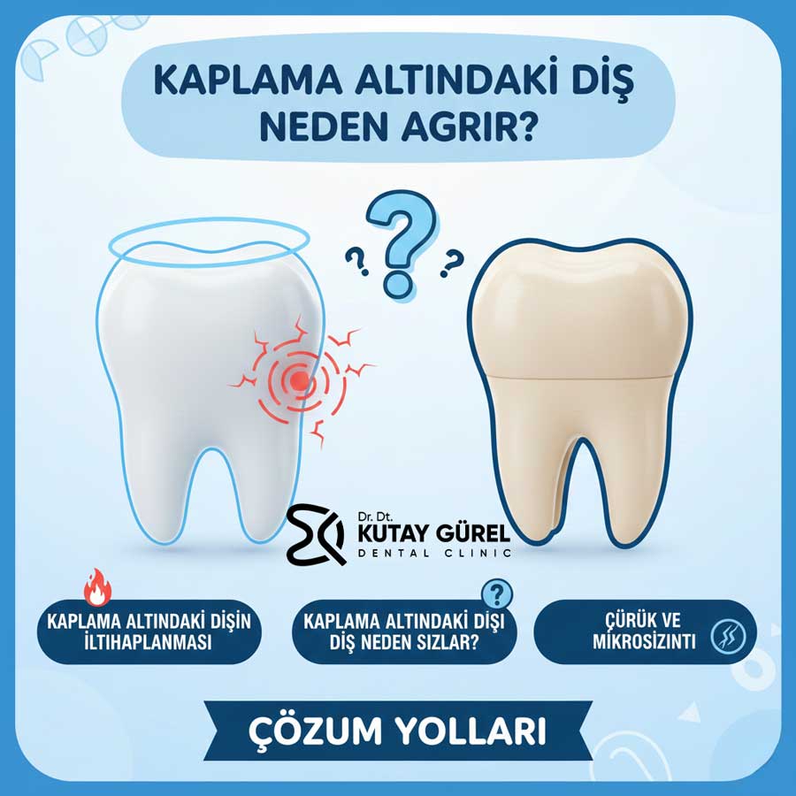 Kaplama Altındaki Diş Neden Ağrır
