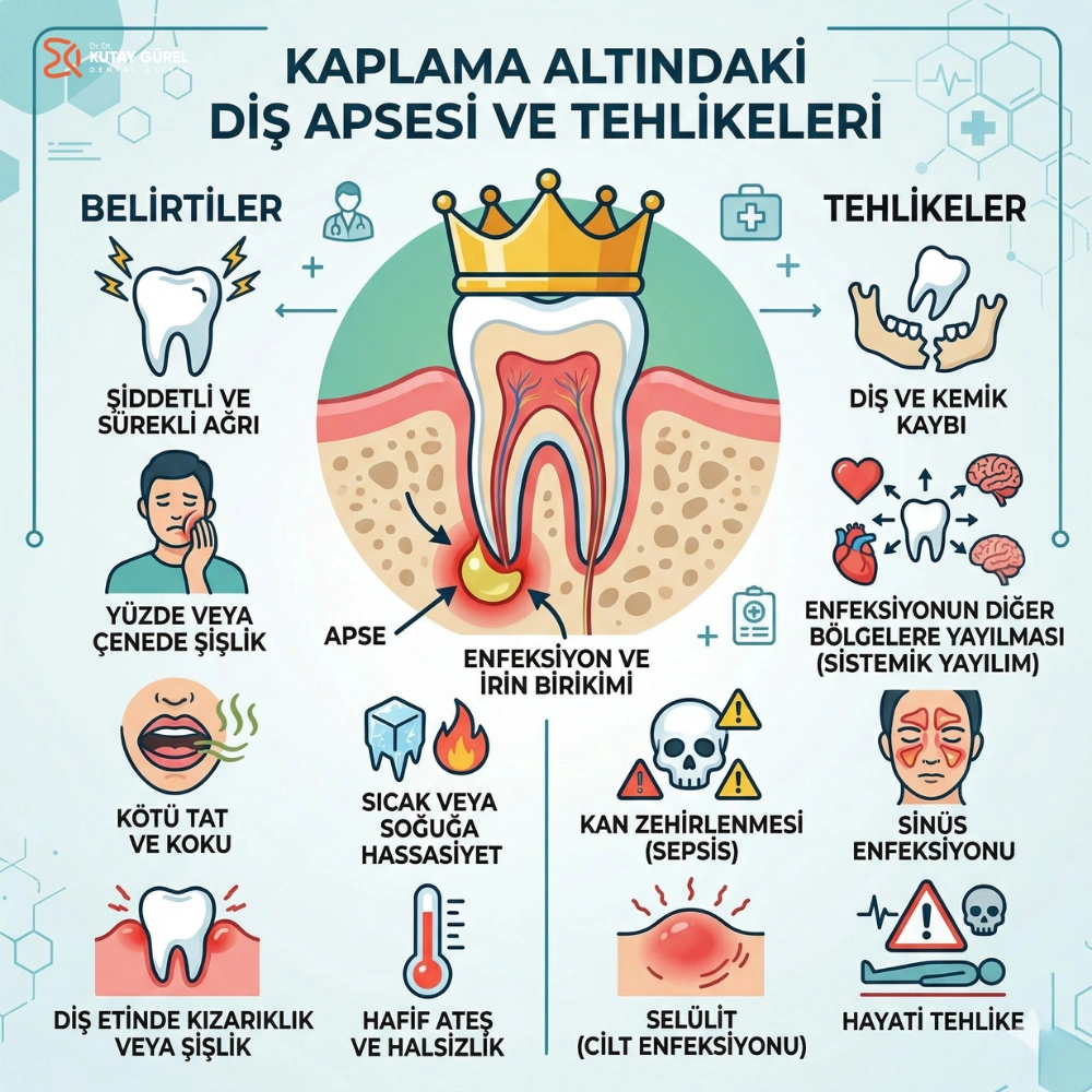 kaplama diş ağrısına ne iyi gelir