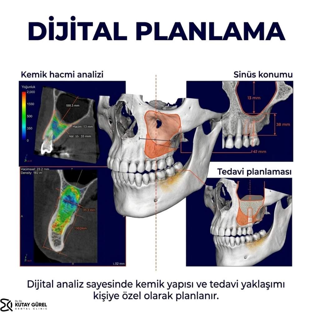 İzmir Çiğli Kemik grefti kimlere uygulanır