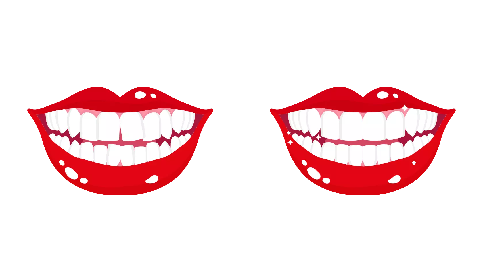 Lamine Diş Kaplama Hangi Durumlarda Uygulanır izmir cigli