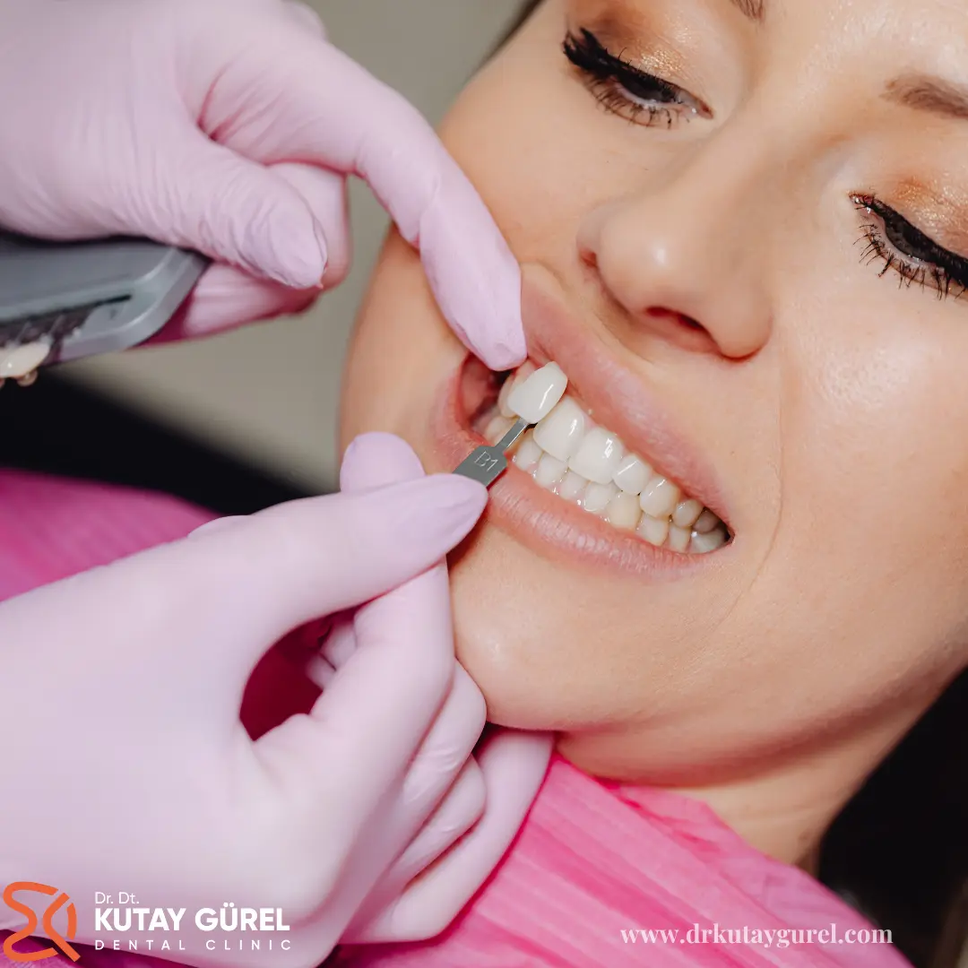 İzmir Çiğli En iyi diş doktoru Dr.Dt. Kutay Gürel Diş Kliniği damakta çıkan diş tedavisi