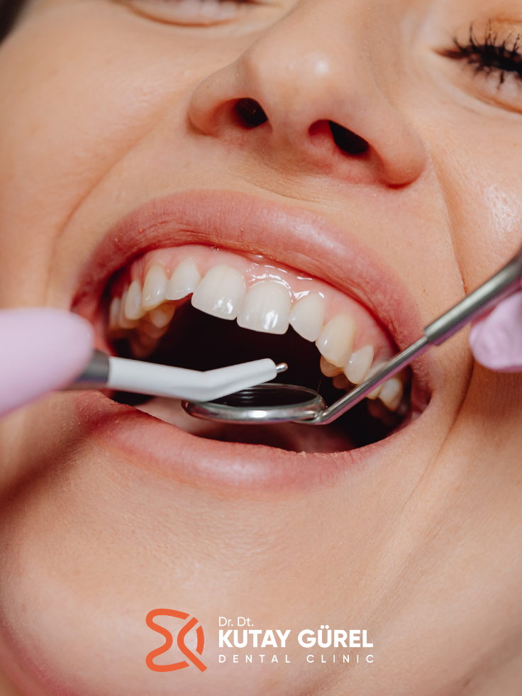 Gripken Kanal Tedavisi Yapılır mı