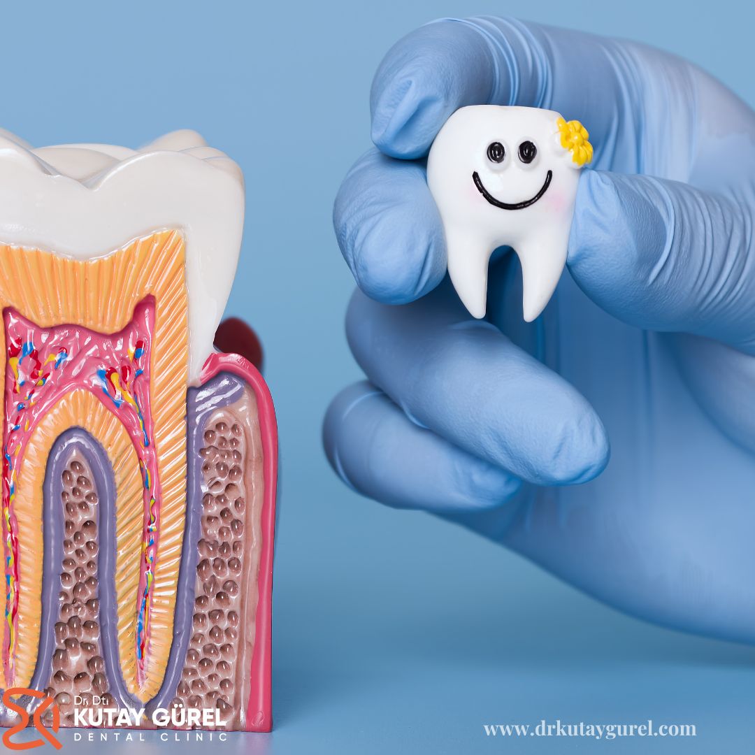 Kırılan Dişin Kökü Kalırsa Ne Olur