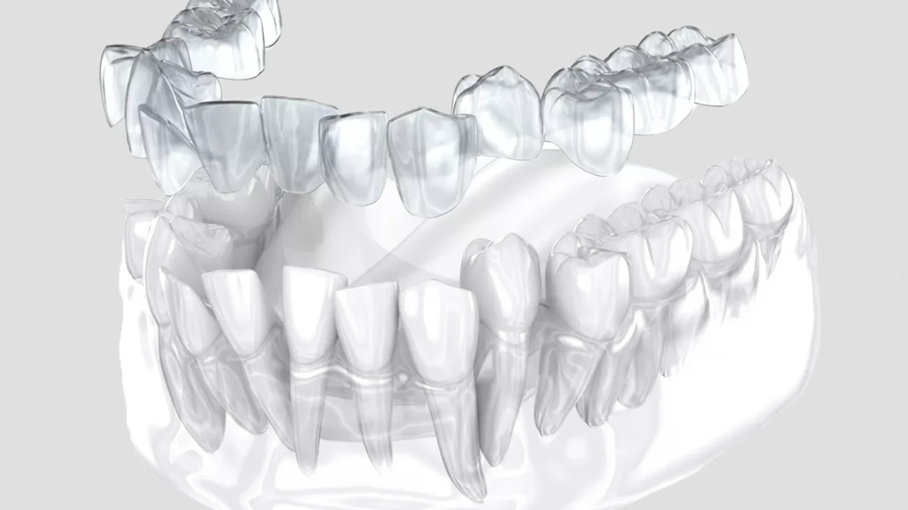 Lamine Diş Kimlere Uygulanmaz izmir cigli