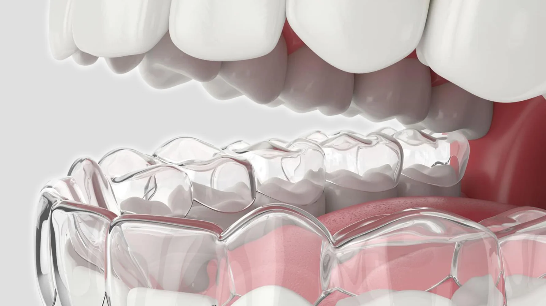 ortodonti izmir ciğli