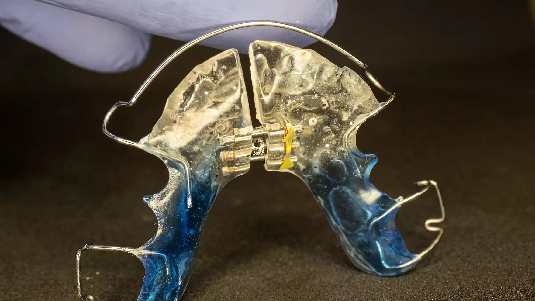 ortodonti izmir cigli