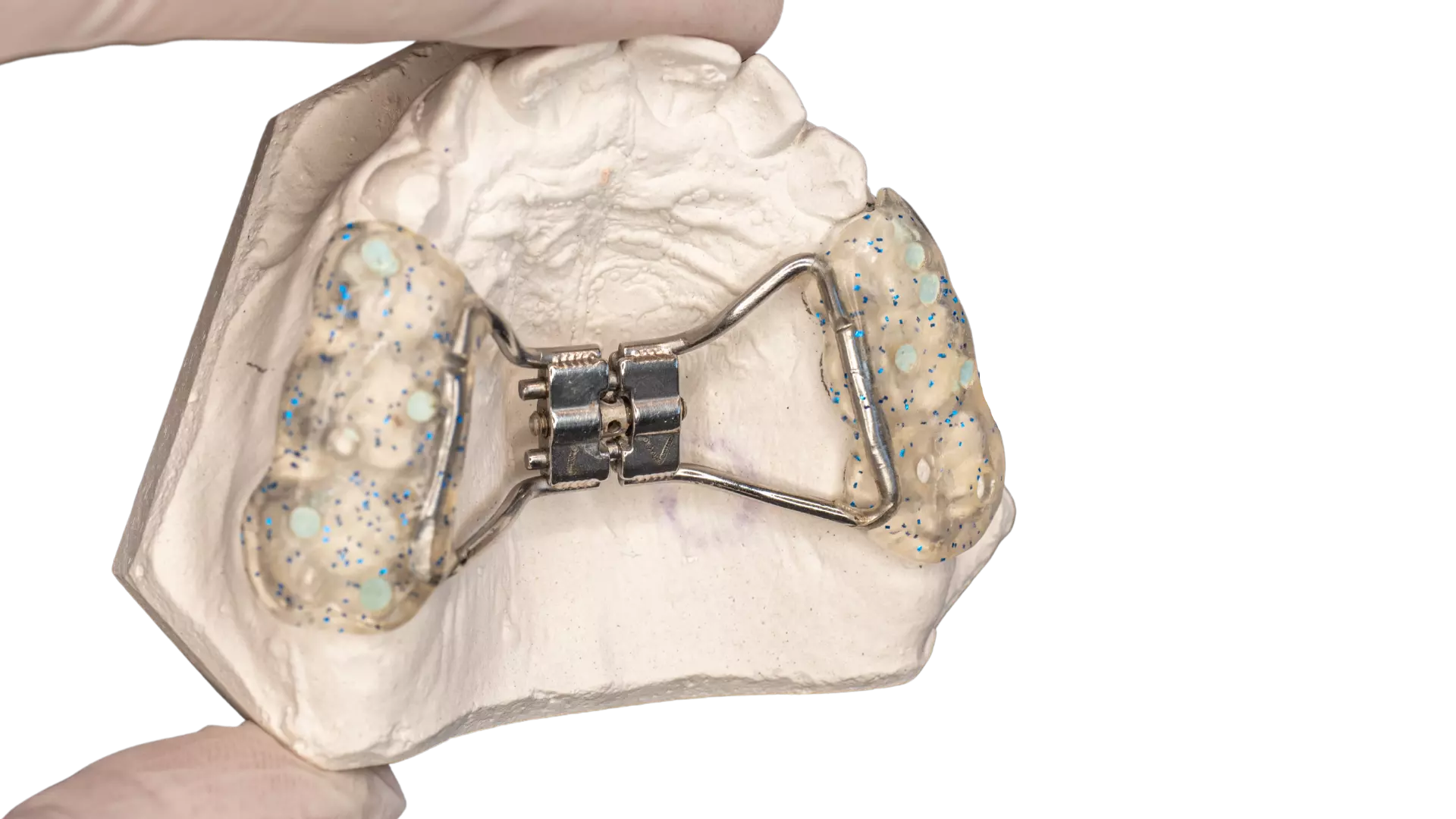 Sabit Ortodontik Aparatlar izmir cigli