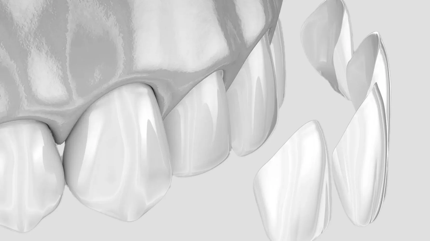 Zirkonyum Diş Kaplama izmir cigli